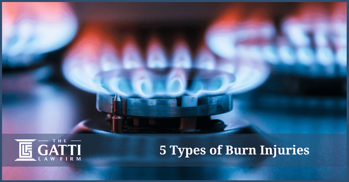 5 Types of Burn Injuries