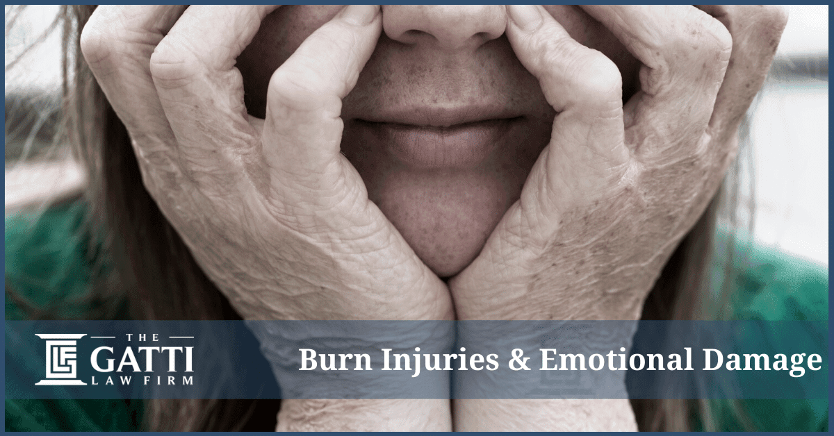 Burn Injuries and Emotional Damages