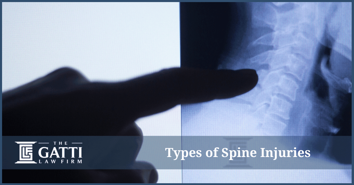 What are the Different Types of Spine Injuries?